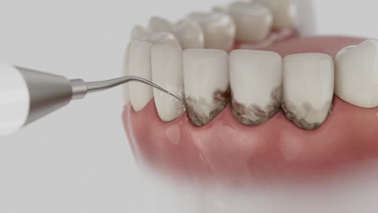 Reliable Emergency Dentist contractor in Clive, IA by Smile Center Dentistry
